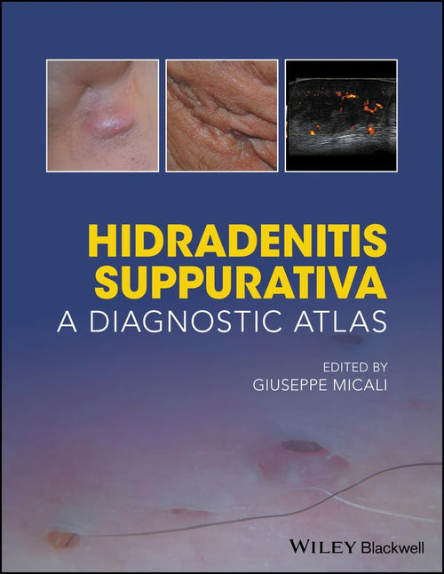 Hidradenitis Suppurativa: A Diagnostic Atlas Paperback