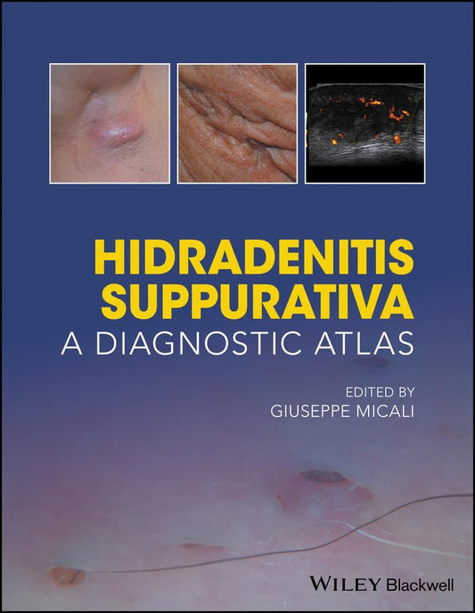 Hidradenitis Suppurativa: A Diagnostic Atlas Paperback
